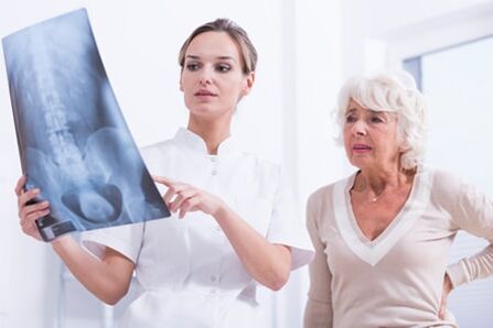 Rentgenové vyšetření je informativním způsobem diagnostiky osteochondrózy páteře