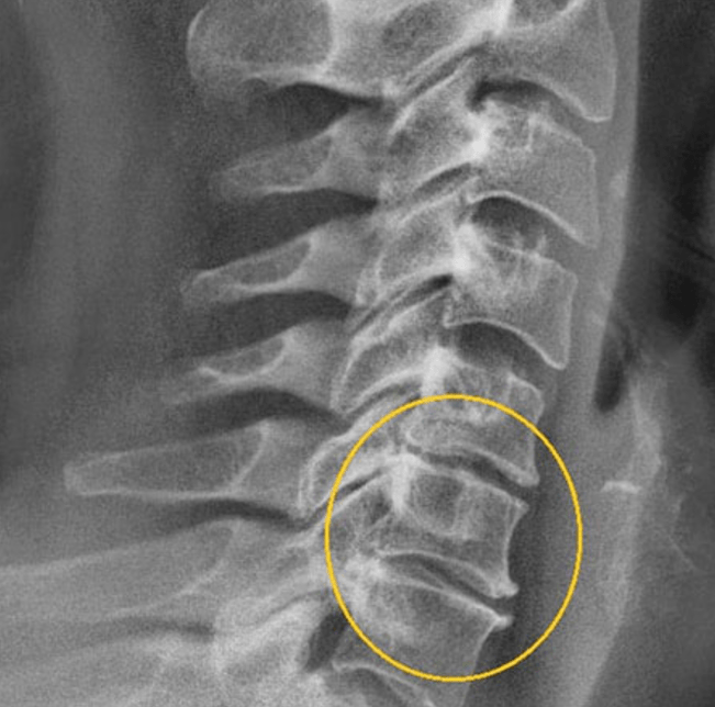 Diagnostický obrázek